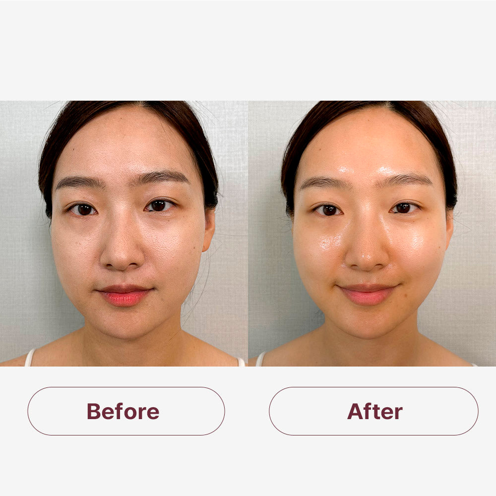 Medisco SkinGlow Mask